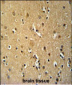 TNFRSF8-Y479 Antibody