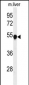 PAH Antibody (Center)