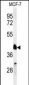 RXRA Antibody (Center)