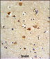 FCGR1A Antibody (Center)
