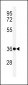 FCGR1A Antibody (Center)