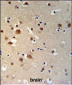 TTBK1 Antibody (N-term)