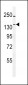 TTBK1 Antibody (N-term)