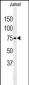 PAN3 Antibody  (C-term)