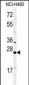 RAB27B  Antibody (C-term)