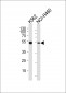 CHEK2 Antibody (N-term)