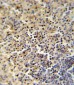 FOLR2 Antibody (N-term)