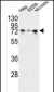 HSPA5 Antibody (Center)