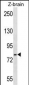 HSPA5 Antibody (Center)