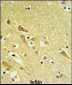 PAAF1 Antibody (N-term)