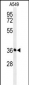 PAAF1 Antibody (N-term)