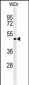 GATA6-Y271 Antibody