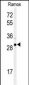 XBP1 Antibody (Center)