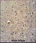 GLD2 Antibody (N-term)