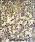 G6PD Antibody (Center)