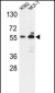 G6PD Antibody (Center)