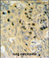 SMARCC1 Antibody (N-term)