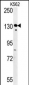 SMARCC1 Antibody (N-term)