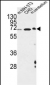 CREBL1 Antibody (C-term)