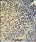 NR5A1 Antibody (N-term)