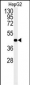 NR5A1 Antibody (N-term)