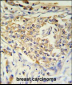 ADFP Antibody (Center)