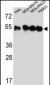 TUBB2C Antibody (Center)