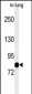 MAP3K11 Antibody