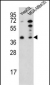 PARP16 Antibody (C-term)