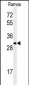 GBAS Antibody (Center)