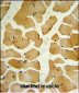 SPHK1 Antibody (C-term R414)