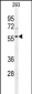 SPHK1 Antibody (C-term R414)