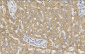 ADFP Antibody (Center)