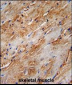 APG8b (MAP1LC3B)-T93/Y99  Antibody (Center)