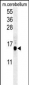 APG8b (MAP1LC3B)-T93/Y99  Antibody (Center)