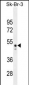CNO6L Antibody (C-term)