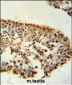 ERO1LB Antibody (C-term)