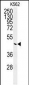 G6PC Antibody (Center)