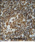 IL1F6 Antibody (Center)