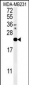 IL1F6 Antibody (Center)