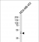 IL5RA Antibody (N-term)