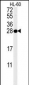 PSME1 Antibody (C-term)