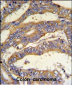 RSAD1 Antibody (C-term)