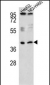 RSAD1 Antibody (C-term)