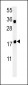 TPC6A Antibody (N-term)