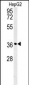 CCND1-Y226 Antibody