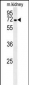 GNE Antibody (C-term)