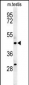 STAMBPL1 Antibody (Center)
