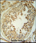 CPNE8 Antibody (N-term)