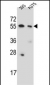 CPNE8 Antibody (N-term)